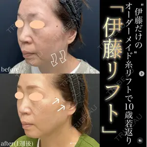 湘南美容クリニック 名古屋駅本院 伊藤 整医師の症例