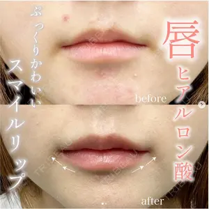 湘南美容クリニック 名古屋駅本院 伊藤 整医師の症例