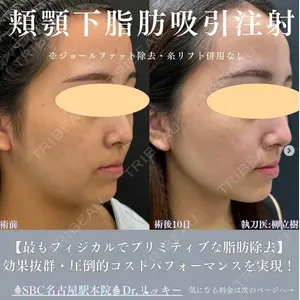 湘南美容クリニック 豊橋院 柳 立樹医師の症例