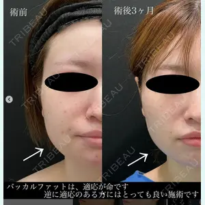 湘南美容クリニック 名古屋駅本院 豊嶋 沙良医師の症例