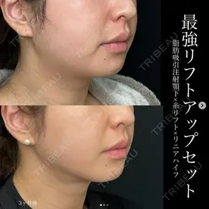 湘南美容クリニック 名古屋駅本院 豊嶋 沙良医師の症例