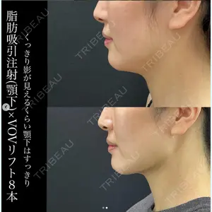 湘南美容クリニック 東京蒲田院の症例