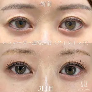ziz CLINIC 村岡 史子医師の症例