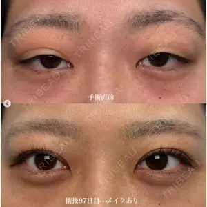 湘南美容クリニック 金山院の症例