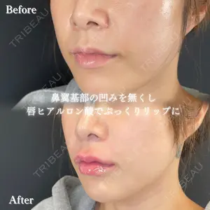 ルラ美容クリニック 大阪本院 平田 一記医師の症例