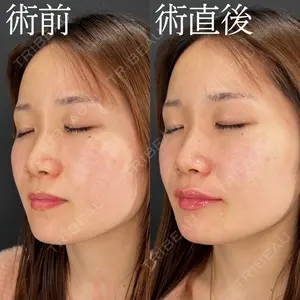 HAAB×DREAM BEAUTY CLINIC 大阪梅田院 柏木 太雅医師の症例