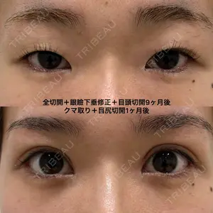 エターナル美容クリニックの症例