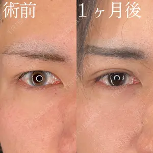症例