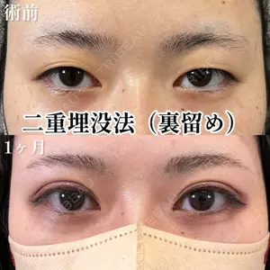 BELINDA CLINIC（ベリンダクリニック）新宿院 梅山 広勝医師の症例