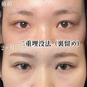 梅山 広勝医師の症例