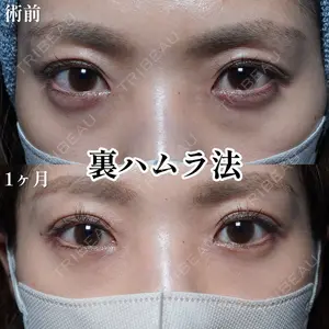BELINDA CLINIC（ベリンダクリニック）新宿院 梅山 広勝医師の症例
