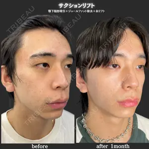 ルラ美容クリニック 神戸院の症例
