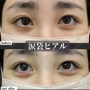 症例