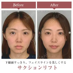 症例