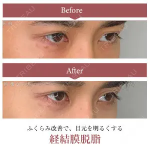症例
