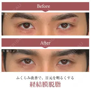 症例