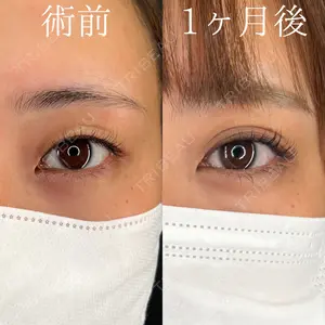 症例
