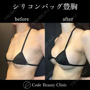 Code Beauty Clinic 名古屋院 橋本 祥平医師の症例