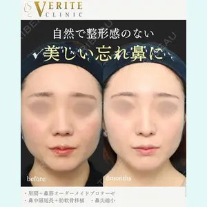 症例