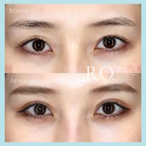 R.O.clinic 呂 秀彦医師の症例