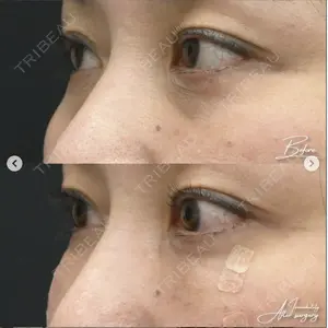 湘南美容クリニック 浜松院の症例