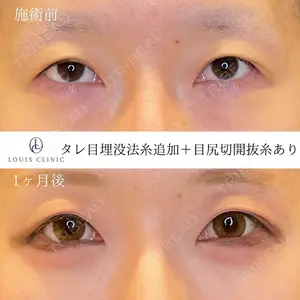 LOUIS CLINIC 二子玉川院【ルイクリニック】 小松 塁医師の症例