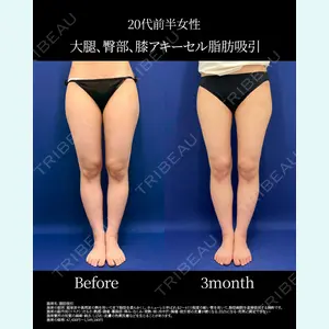湘南美容クリニック 名古屋院 山本 高士医師の症例