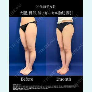 湘南美容クリニック 名古屋院 山本 高士医師の症例