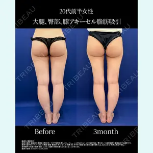 湘南美容クリニック 名古屋院 山本 高士医師の症例