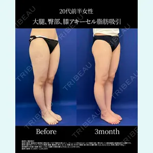 湘南美容クリニック 名古屋院 山本 高士医師の症例