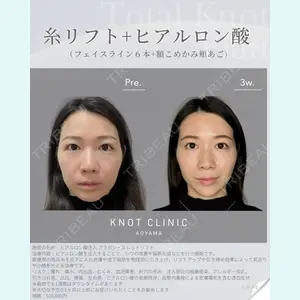 KNOT CLINIC AOYAMAの症例