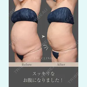症例