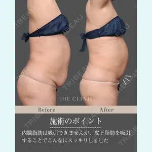 症例