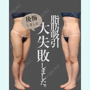 症例