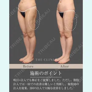 症例