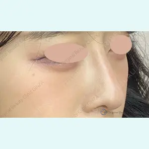 Original Beauty Clinic GINZA 佐藤玲史医師の症例
