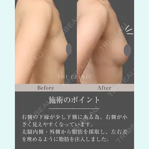 THE CLINIC（ザ・クリニック） 東京院 三塚 健太郎医師の症例