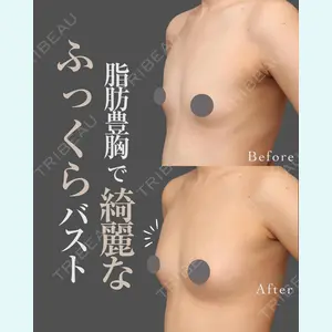 症例