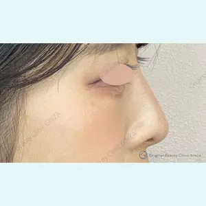 Original Beauty Clinic GINZA 佐藤玲史医師の症例