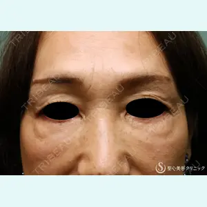 症例