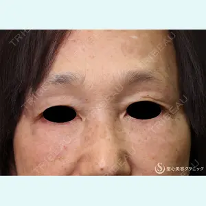 症例