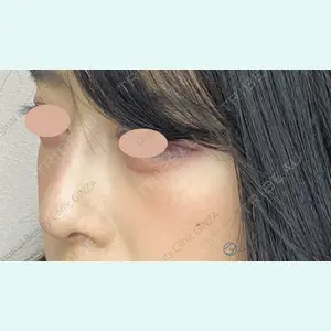 Original Beauty Clinic GINZA 佐藤玲史医師の症例