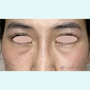 Original Beauty Clinic GINZA 佐藤玲史医師の症例