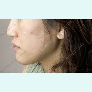 Original Beauty Clinic GINZA 佐藤玲史医師の症例