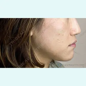 Original Beauty Clinic GINZA 佐藤玲史医師の症例