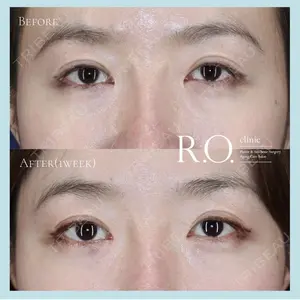 R.O.clinic 呂 秀彦医師の症例