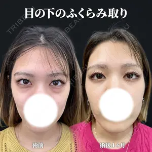 症例