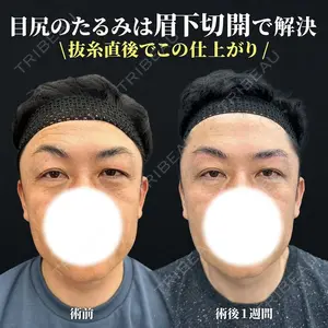 症例