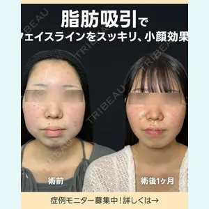 症例