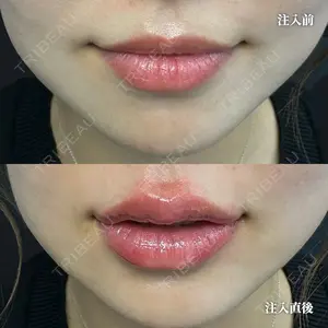 症例
